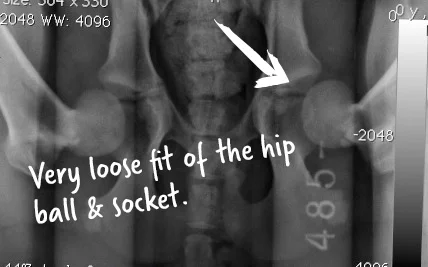 hip-1