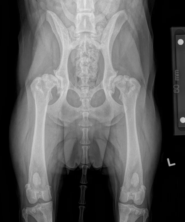 hip-dysplasia