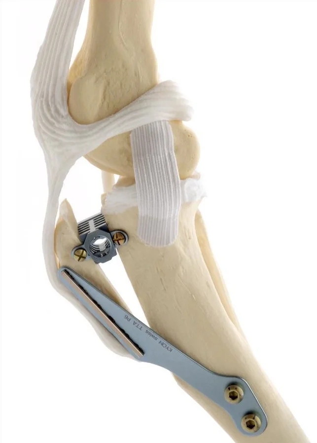 img-TTA-bone