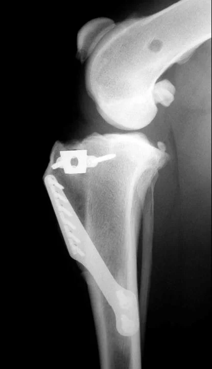 img-TTA-xray
